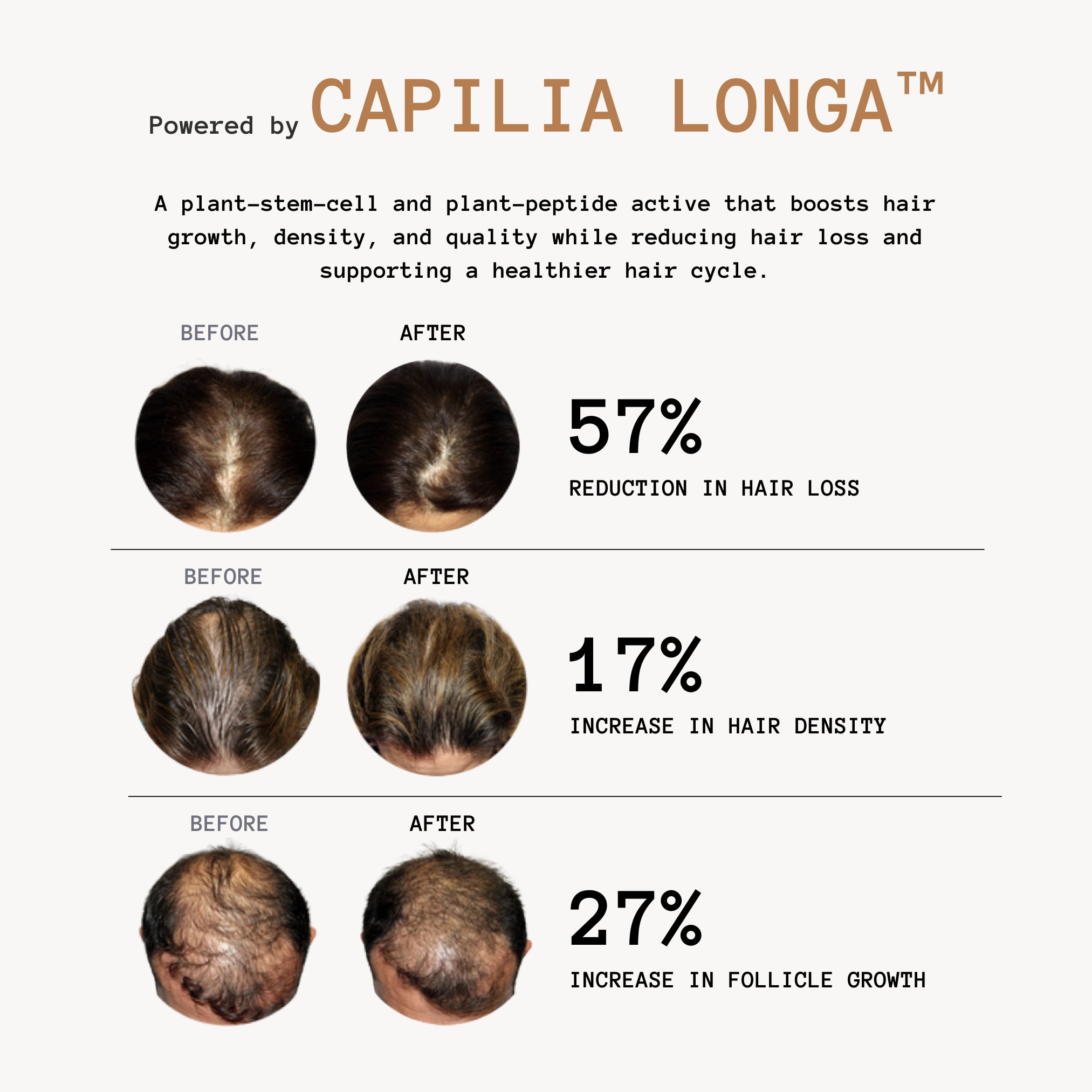 Thickening Hair Growth Combo