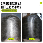 Follicle Activating Hair Growth System
