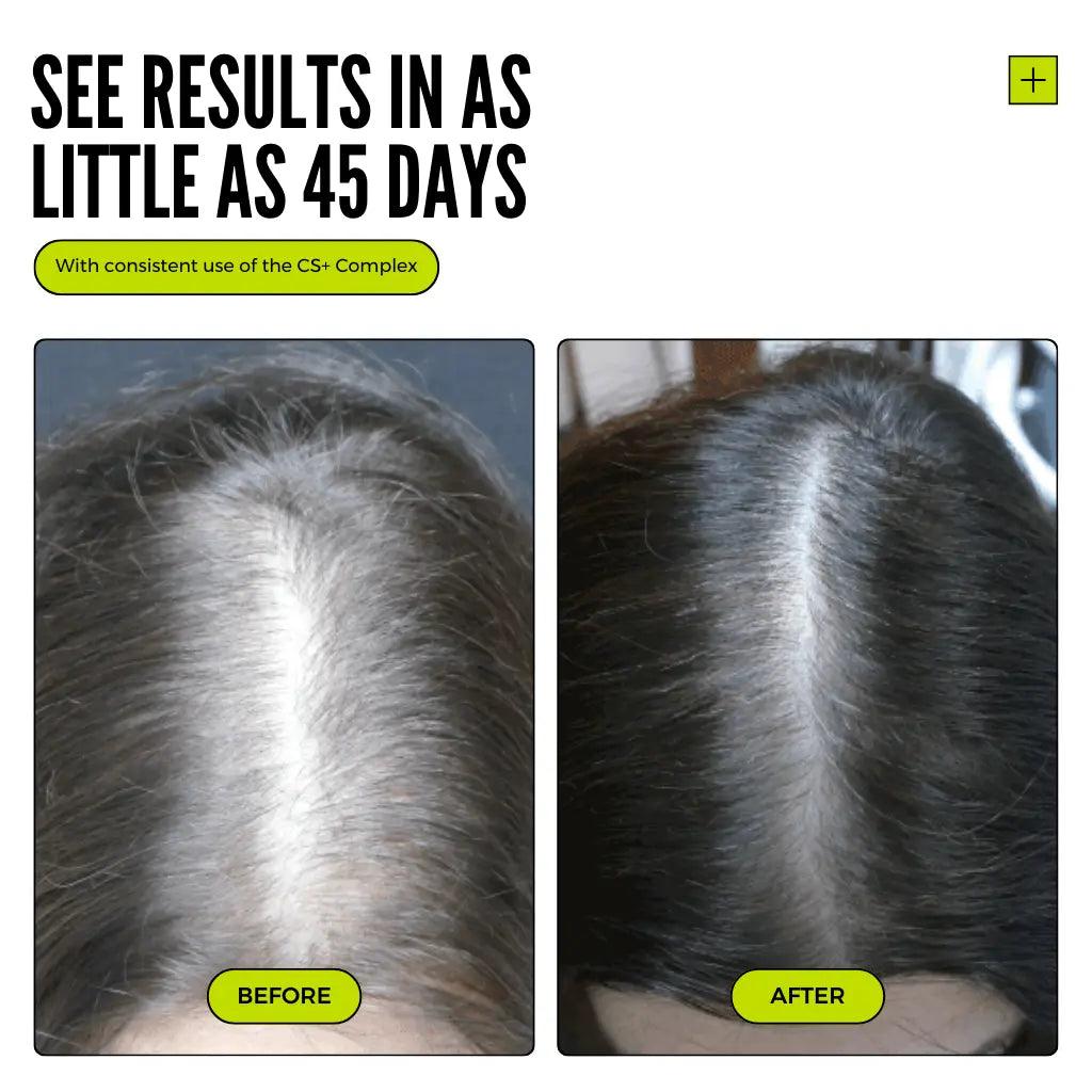 Thickening+ Hair Growth System ( Test )