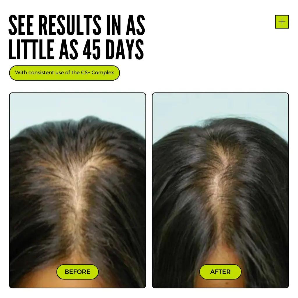 Thickening+ Hair Growth System ( Test )