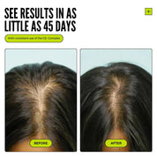 Follicle Activating Hair Growth System