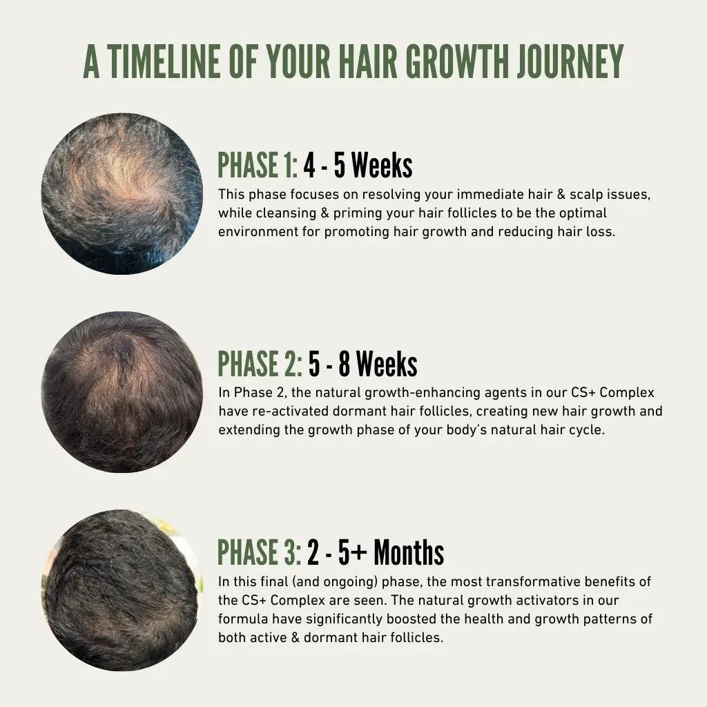 Thickening Hair Growth Combo  + Cloud Cream Set