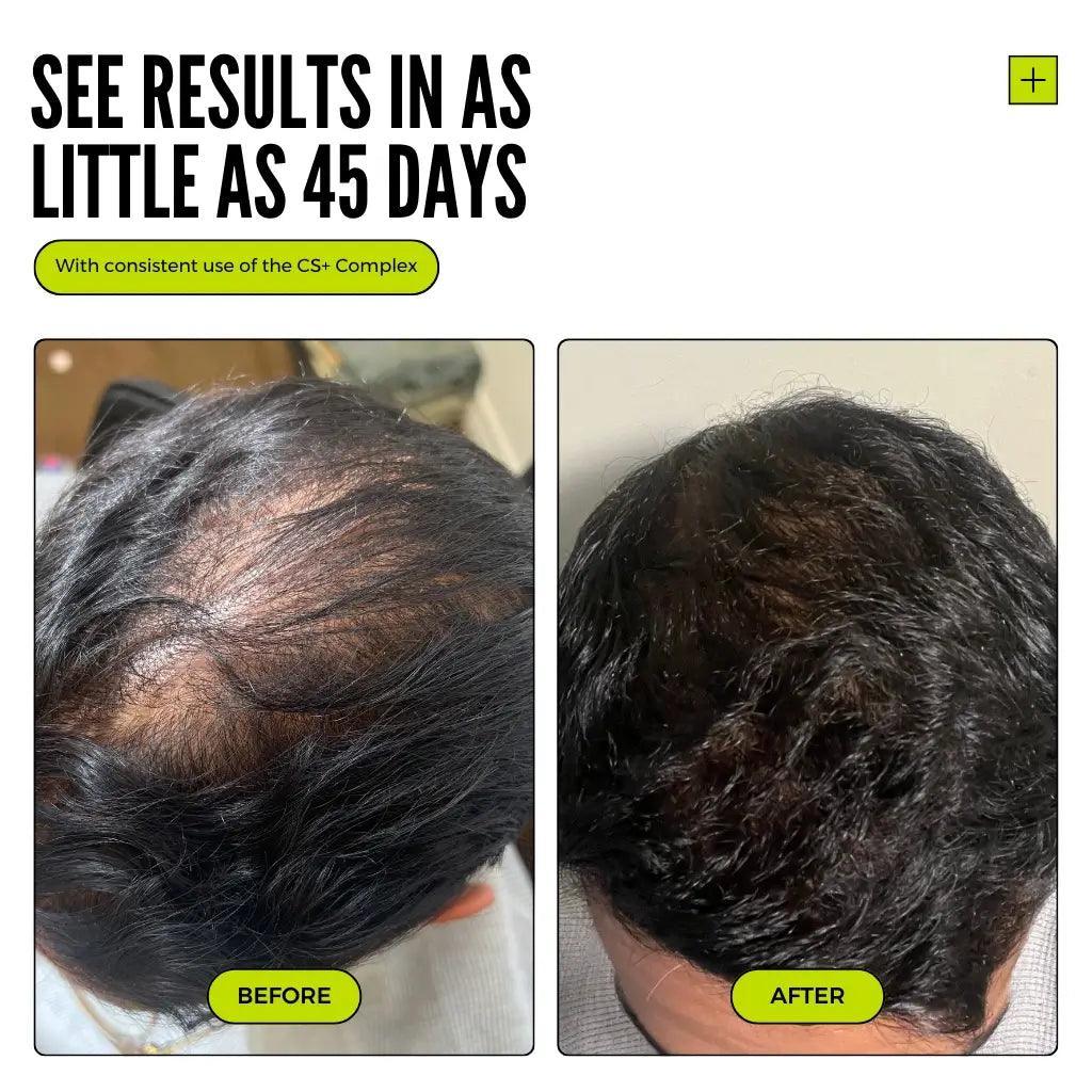 Thickening Hair Growth Combo  + Cloud Cream Set