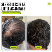 Thickening Hair Growth Combo  + Cloud Cream Set