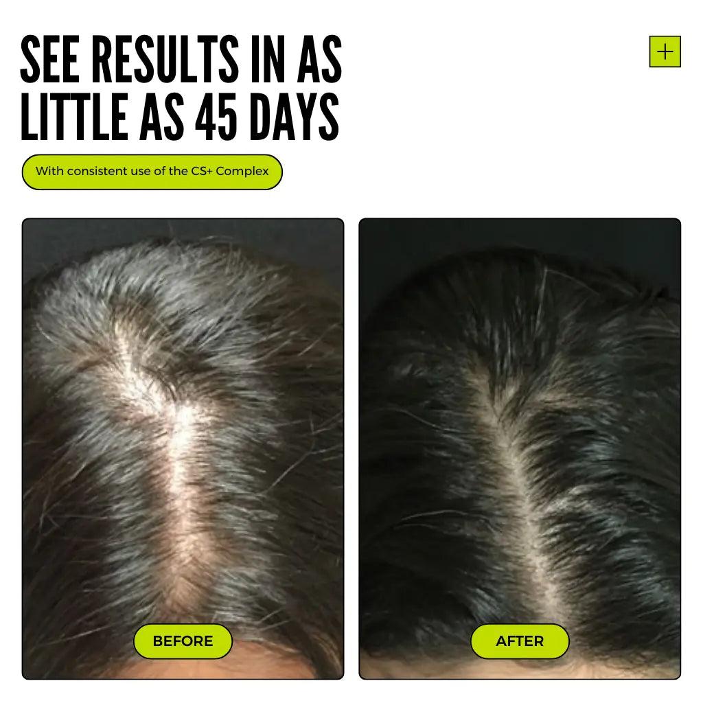 Thickening+ Hair Growth System ( Test )