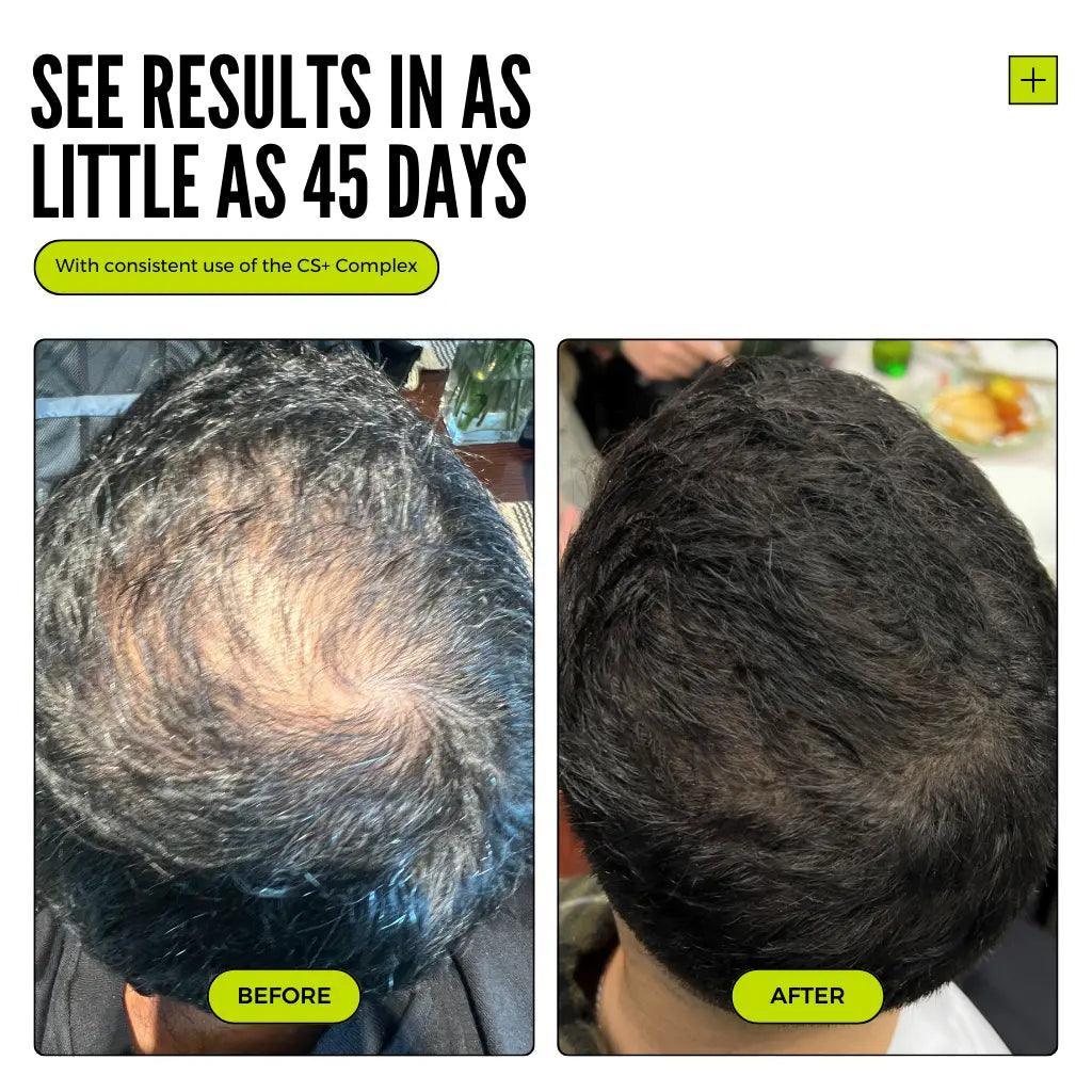 Thickening Hair Growth Combo  + Cloud Cream Set