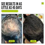 Thickening Hair Growth Combo  + Cloud Cream Set