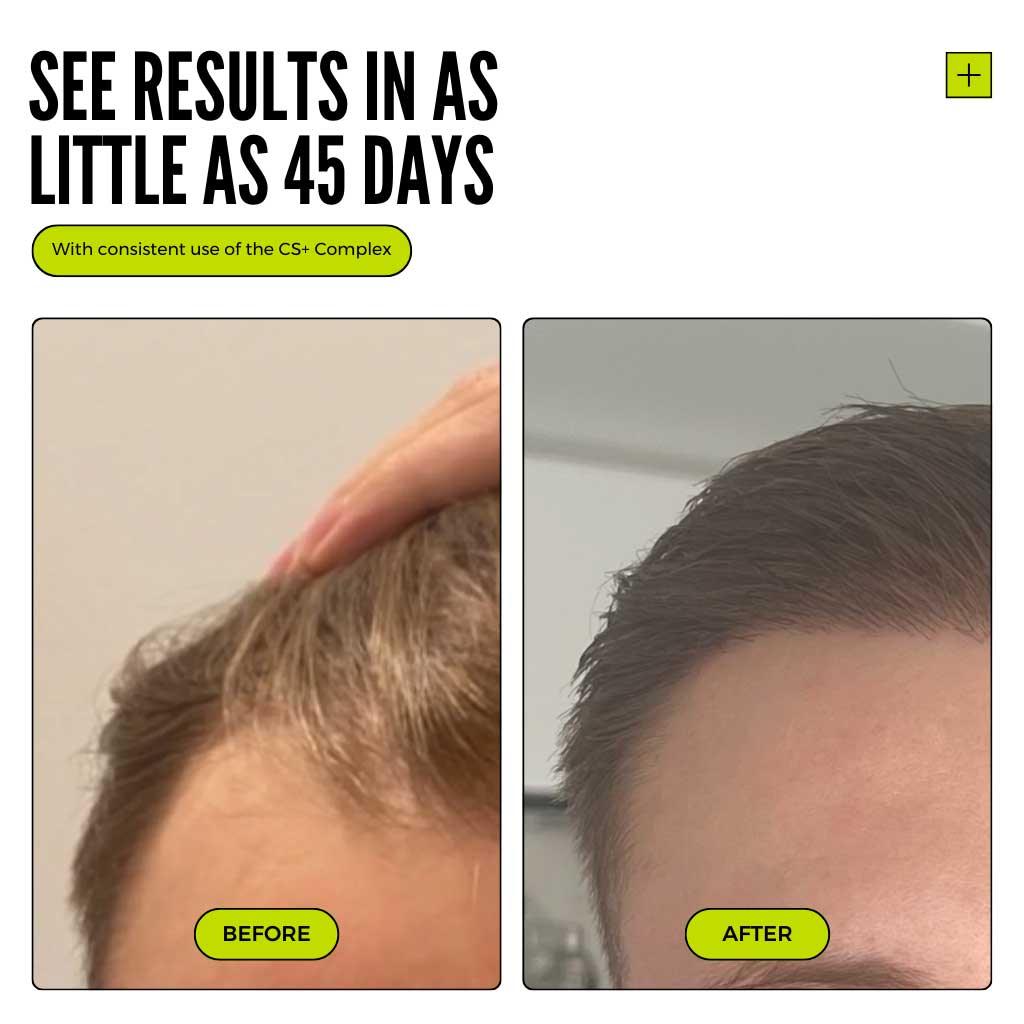 Thickening Hair Growth Combo + Hybrid Styler Set