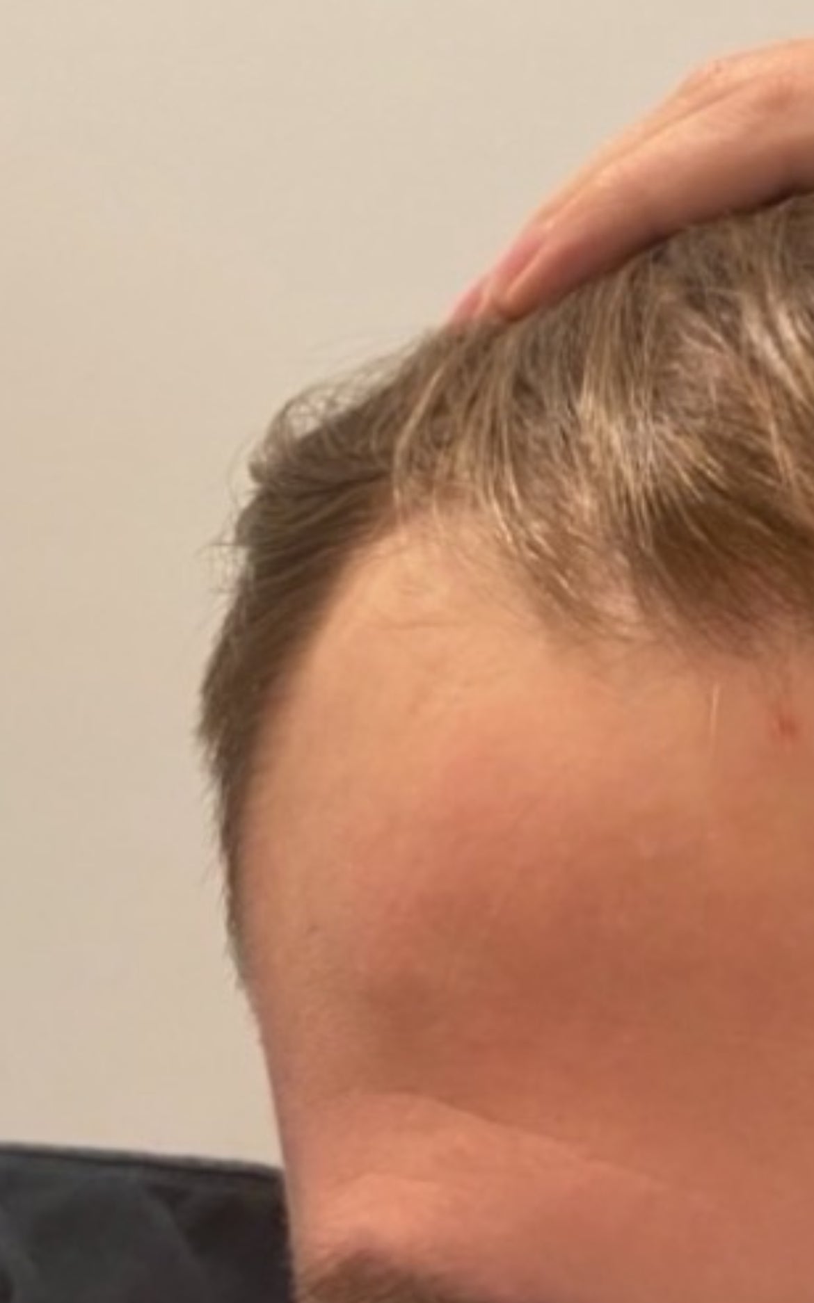Before