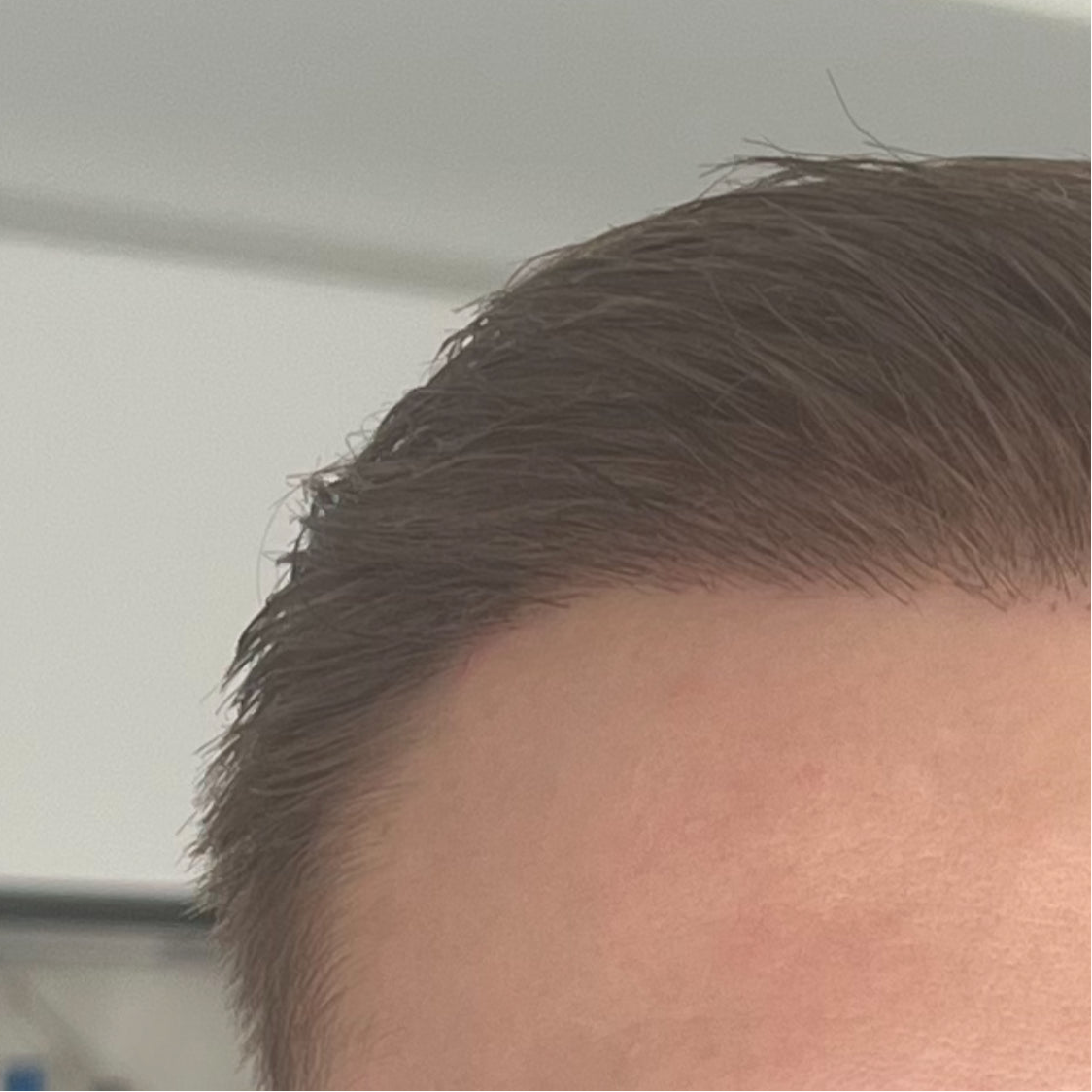 After