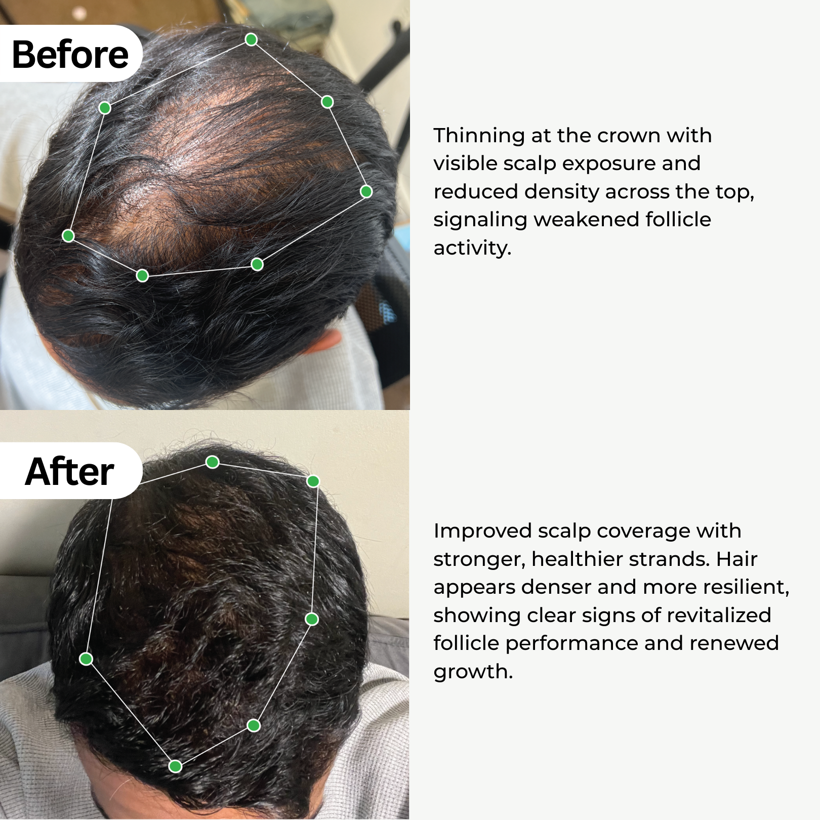 BioActivate Hair Growth System