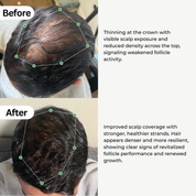 BioActivate Hair Growth System