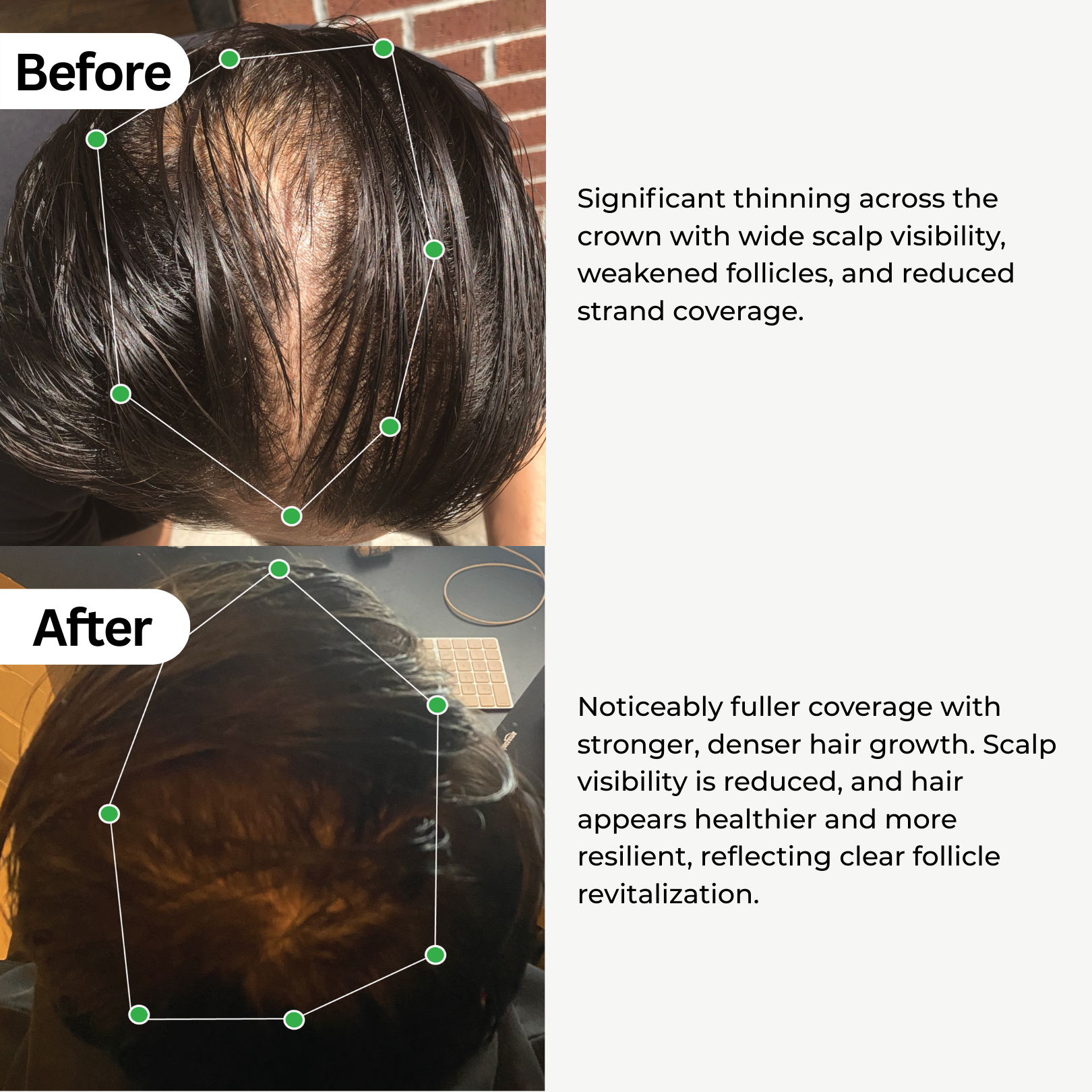 BioActivate Hair Growth System