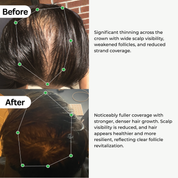 BioActivate Hair Growth System