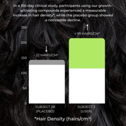 BioActivate Hair Growth System