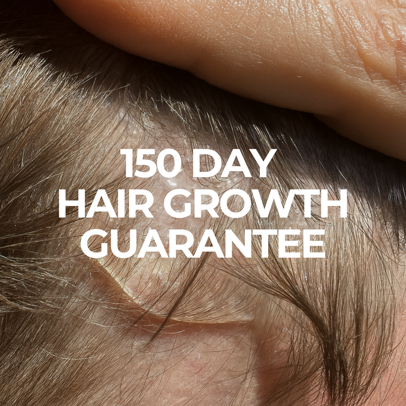 BioActivate Hair Growth System