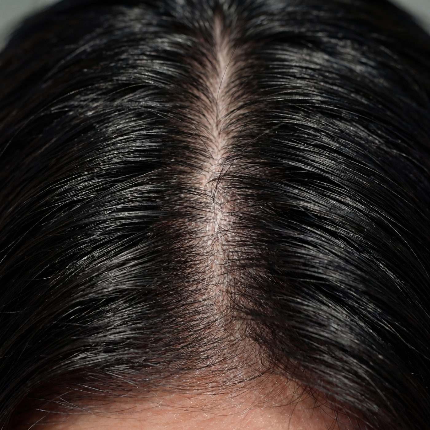 After treatment