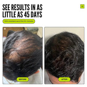 Restore & Strengthen Hair Growth Combo + Hybrid Styler Set