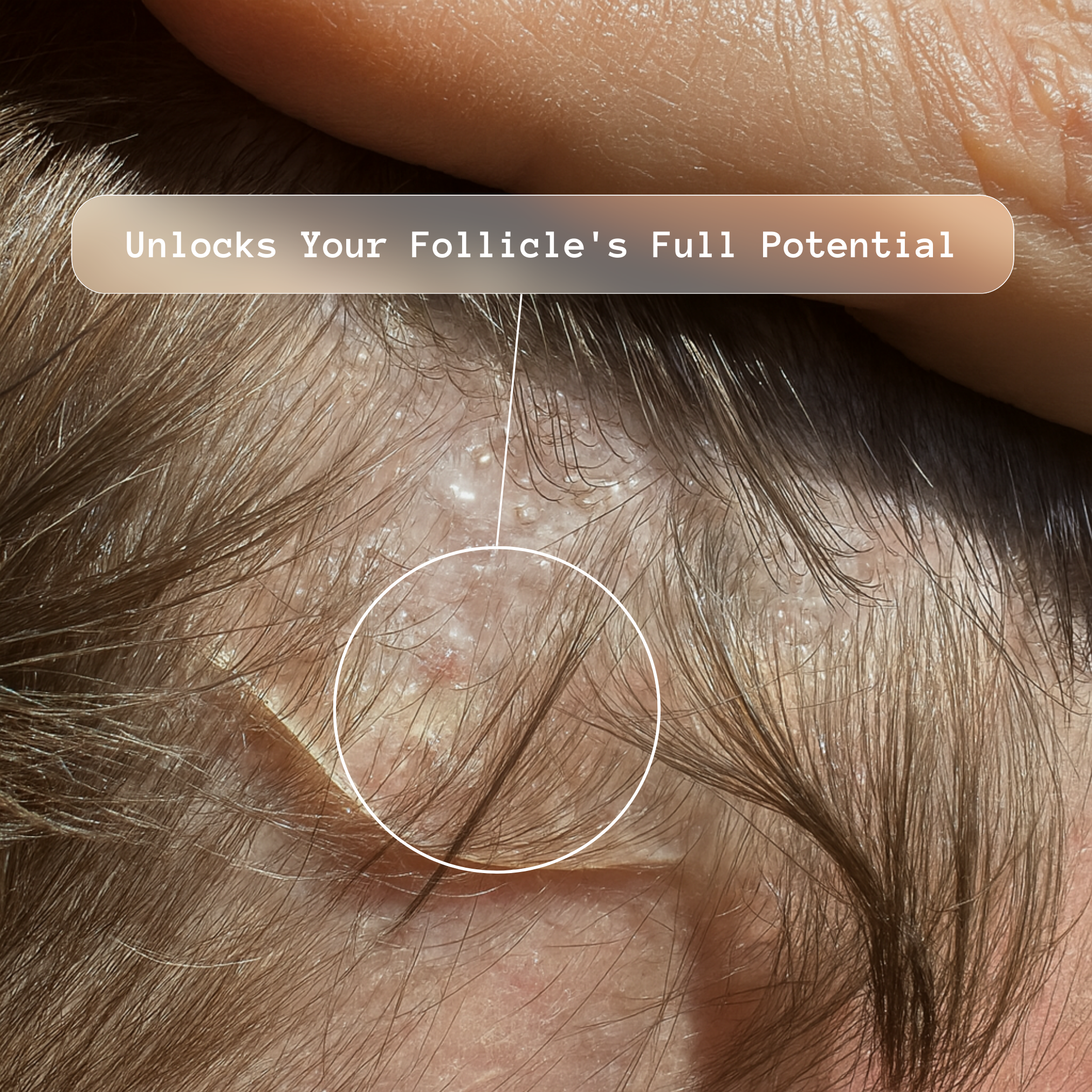 Thickening Hair Growth Combo