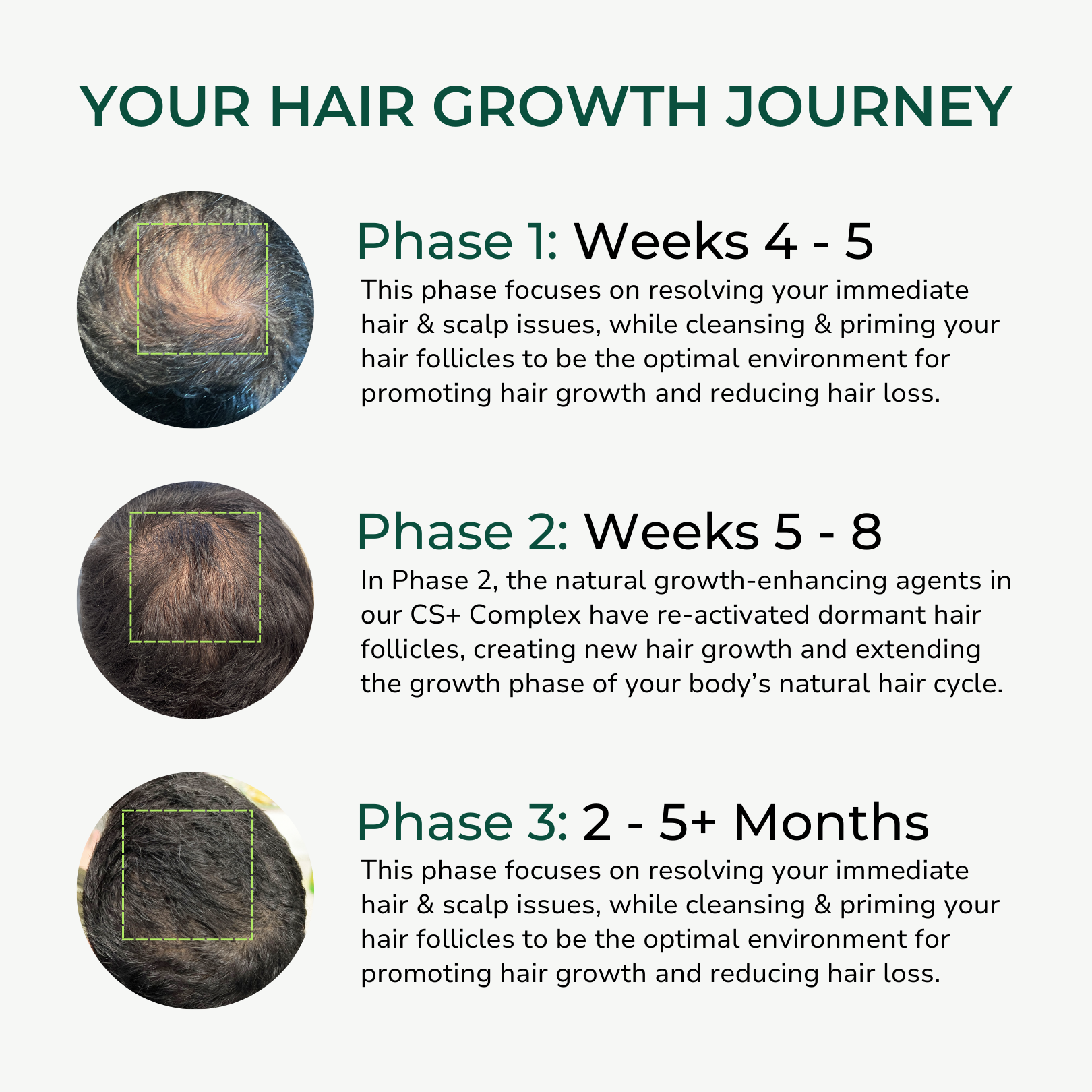 Follicle Activating Hair Growth System