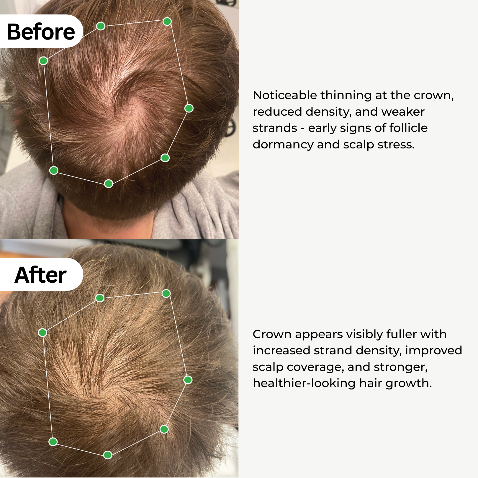 BioActivate Hair Growth System