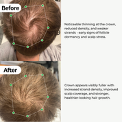 BioActivate Hair Growth System