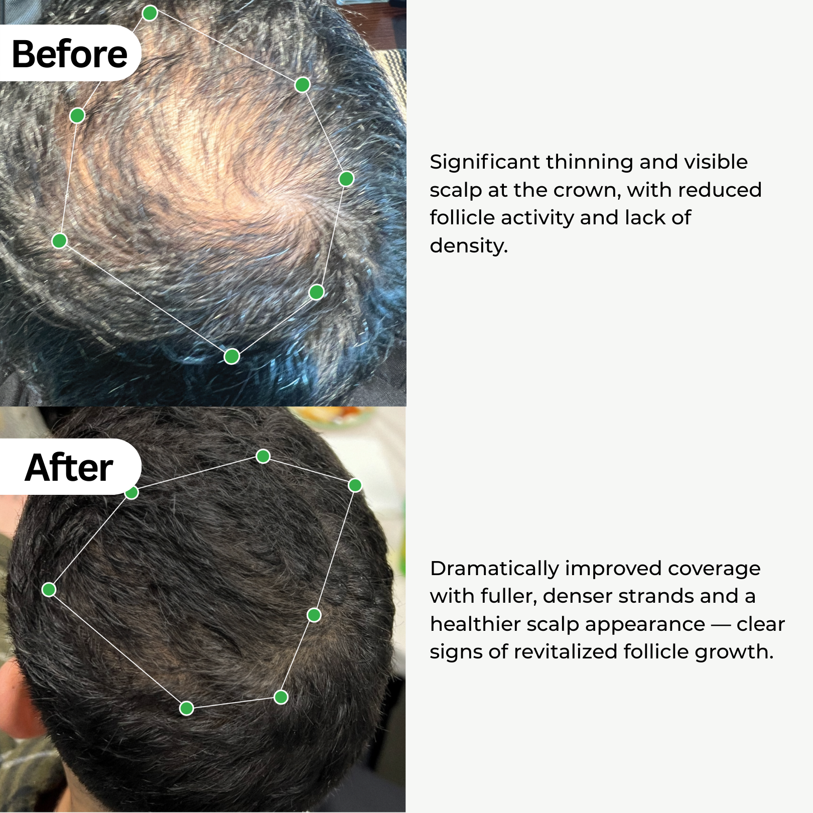 BioActivate Hair Growth System