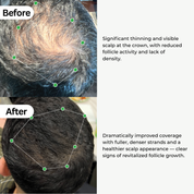 BioActivate Hair Growth System