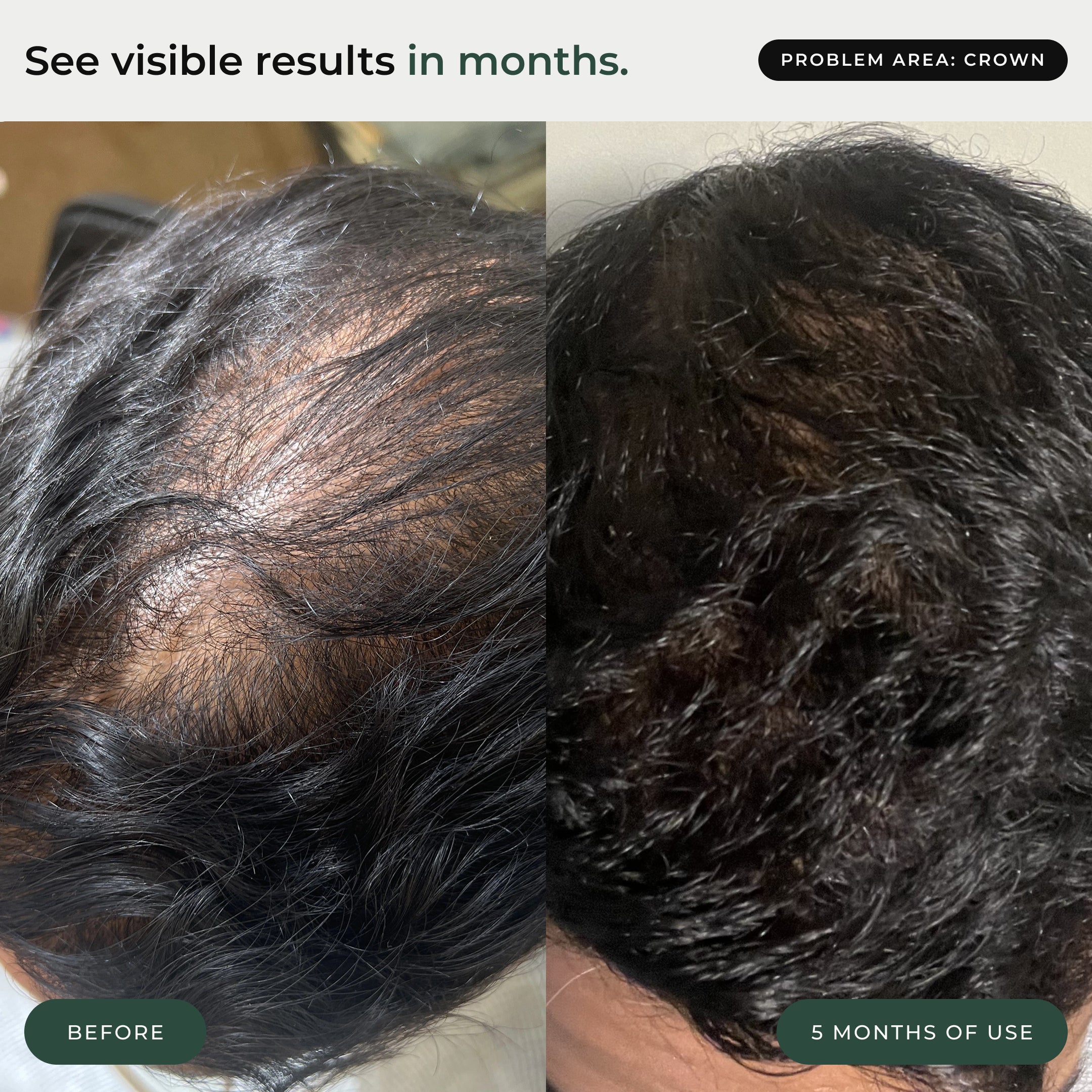 The Thickening Routine