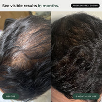 BioActivate+ Hair Serum