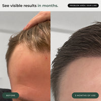 BioActivate+ Hair Serum
