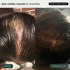 BioActivate+ Hair Serum