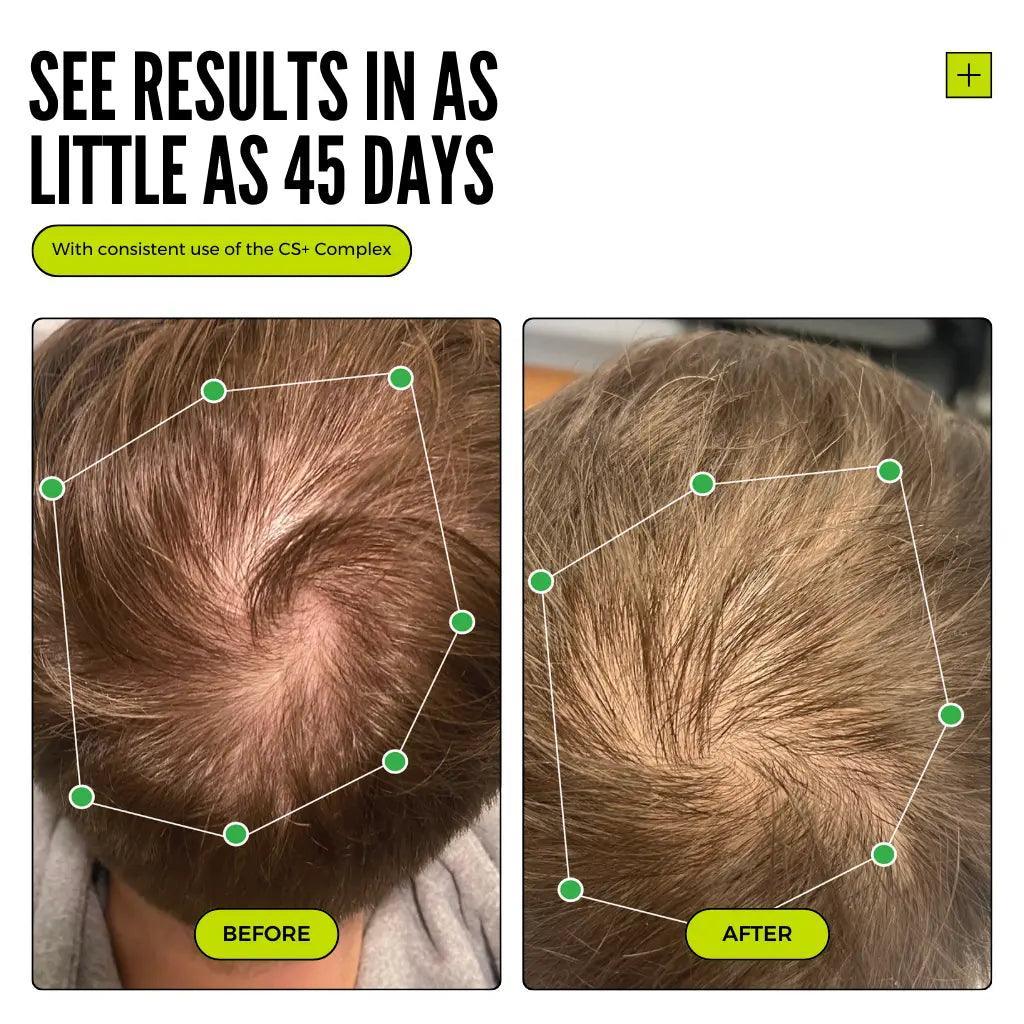 Restorative Hair Growth Combo