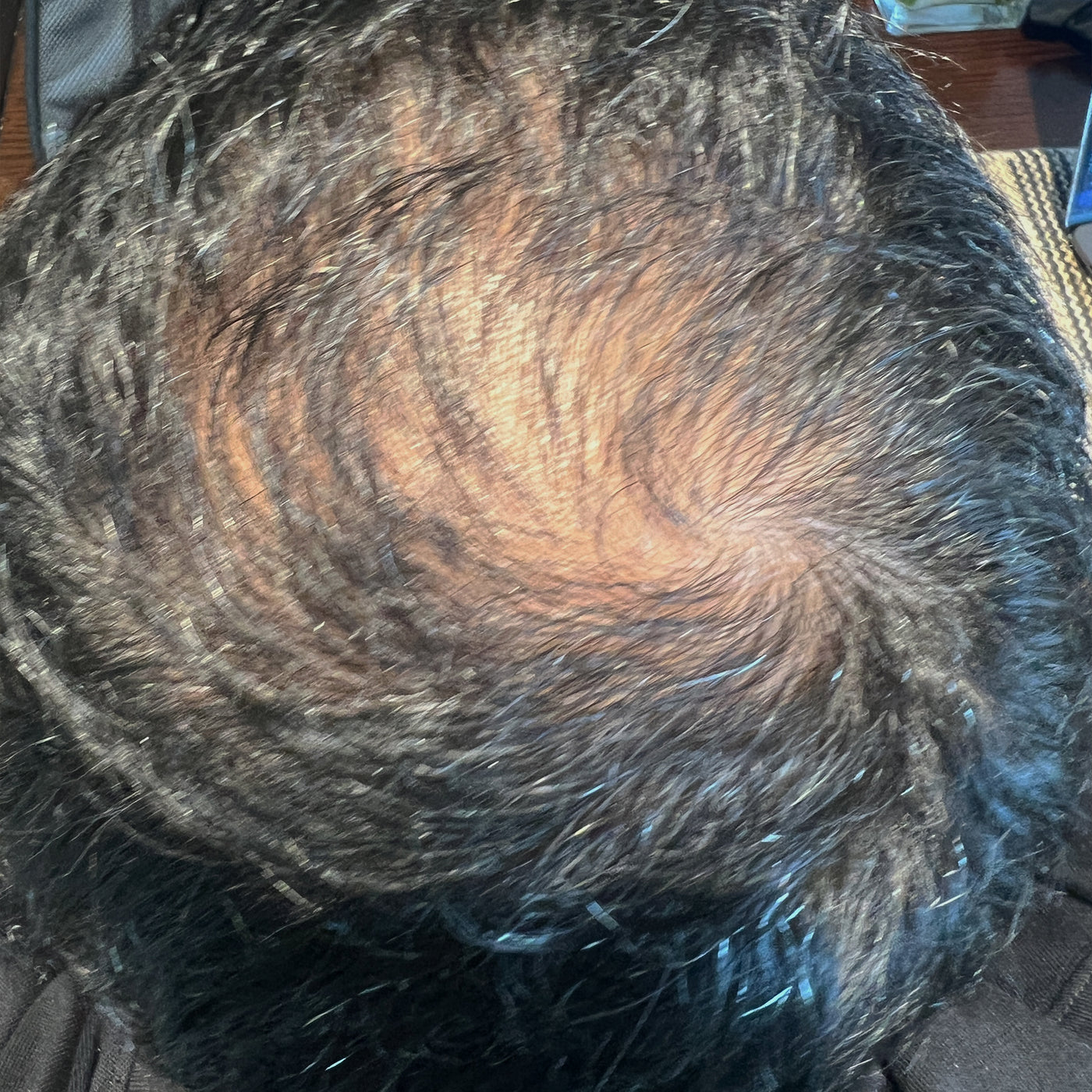Before