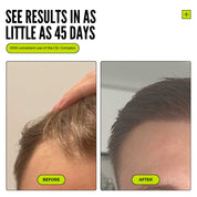 Thickening Hair Growth Combo